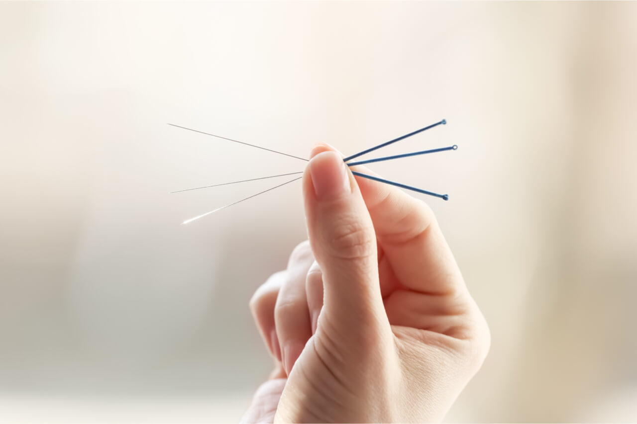 Acupuncture For Neuropathy What Experts Say NYSRA 